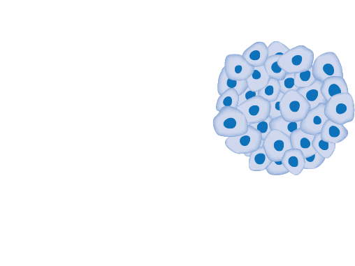 what is cancer infographic